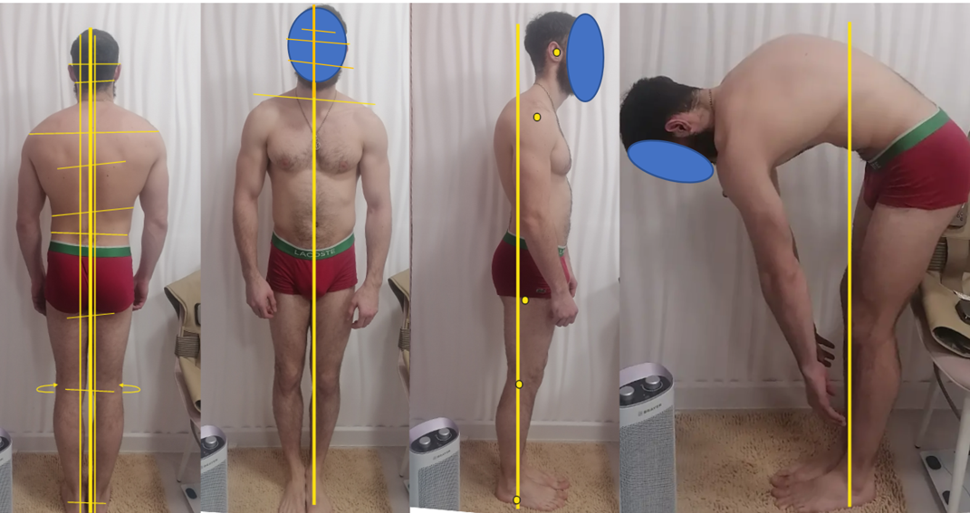 Клинический случай.