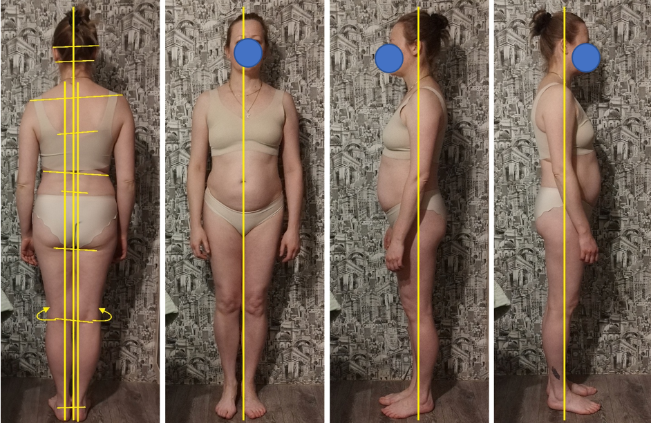 Он-лайн консультация