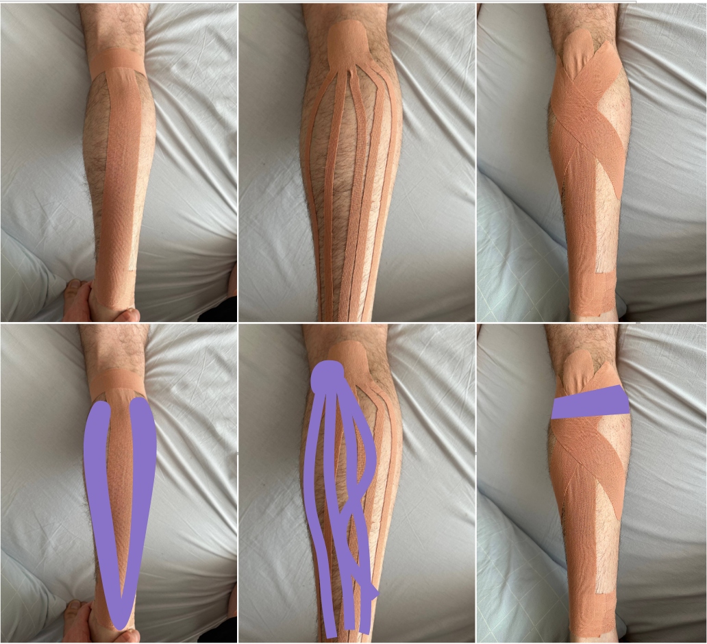 Разбираем ошибки тейпирования