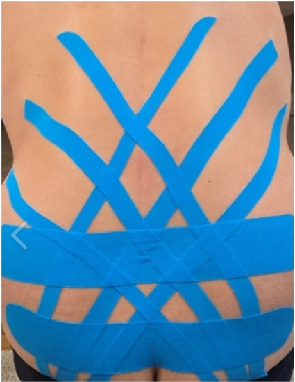 Разбор тейпирования